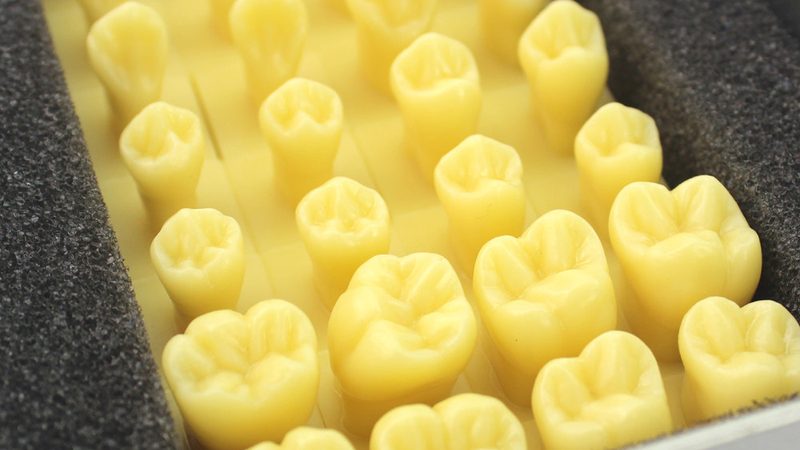 正畸保持器价格之谜：揭秘影响价格的关键因素**